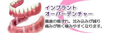 インプラントオーバーデンチャー